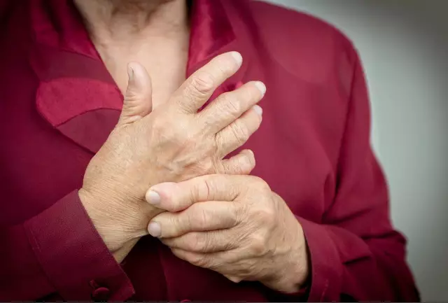 Hautausschläge Bei Rheumatoider Arthritis: Bilder, Symptome Und Behandlungen