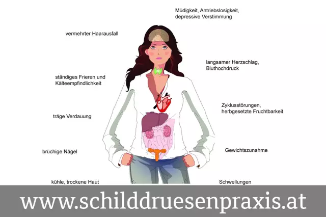 Muttermilch-Gelbsucht: Ursachen, Symptome Und Diagnose