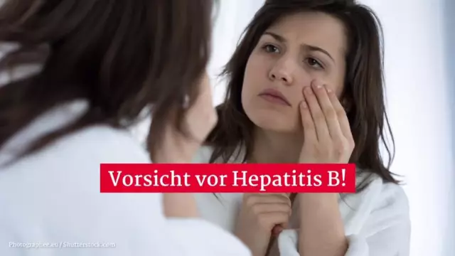 Hepatitis E: Symptome, Behandlung Und Prävention