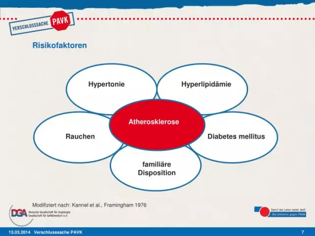 Perifer Kärlsjukdom: Typer, Orsaker Och Riskfaktorer