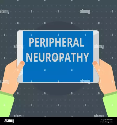 Periphere Neuropathie: Ursachen, Symptome Und Behandlungen